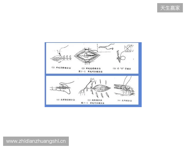 广州豹官方:杨浩眉弓伤口缝合30余针,预计5-7天后拆线 广州豹官方:杨浩眉弓伤口缝合30余针,预计5-7天后拆线